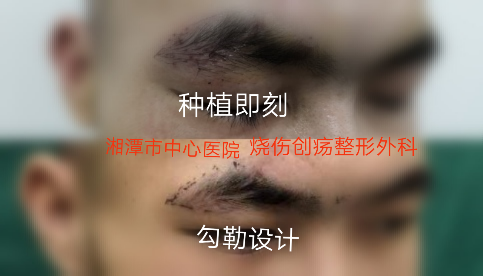 暂无