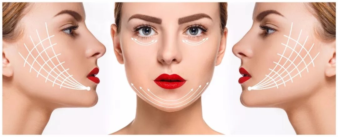 线雕真的是万能术式吗?如何搭配效果才更好? - 好大夫在线