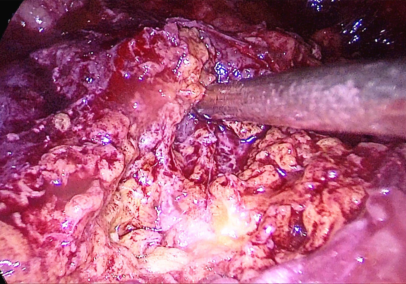 流感危机_流感来势汹汹危害却被低估_流感的危险性