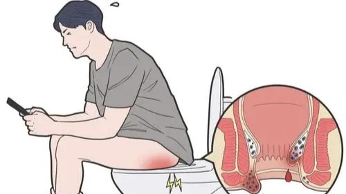 圖文圖片