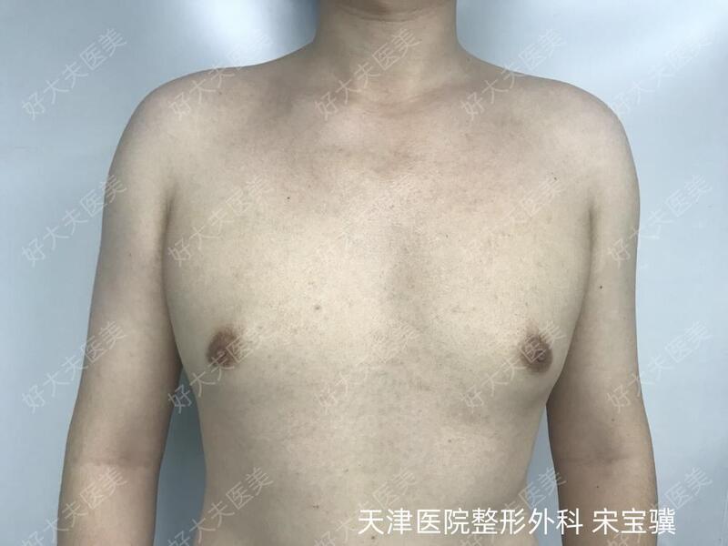 圖文圖片