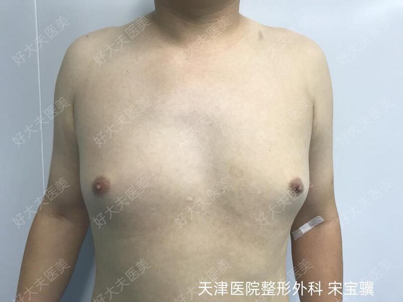 圖文圖片