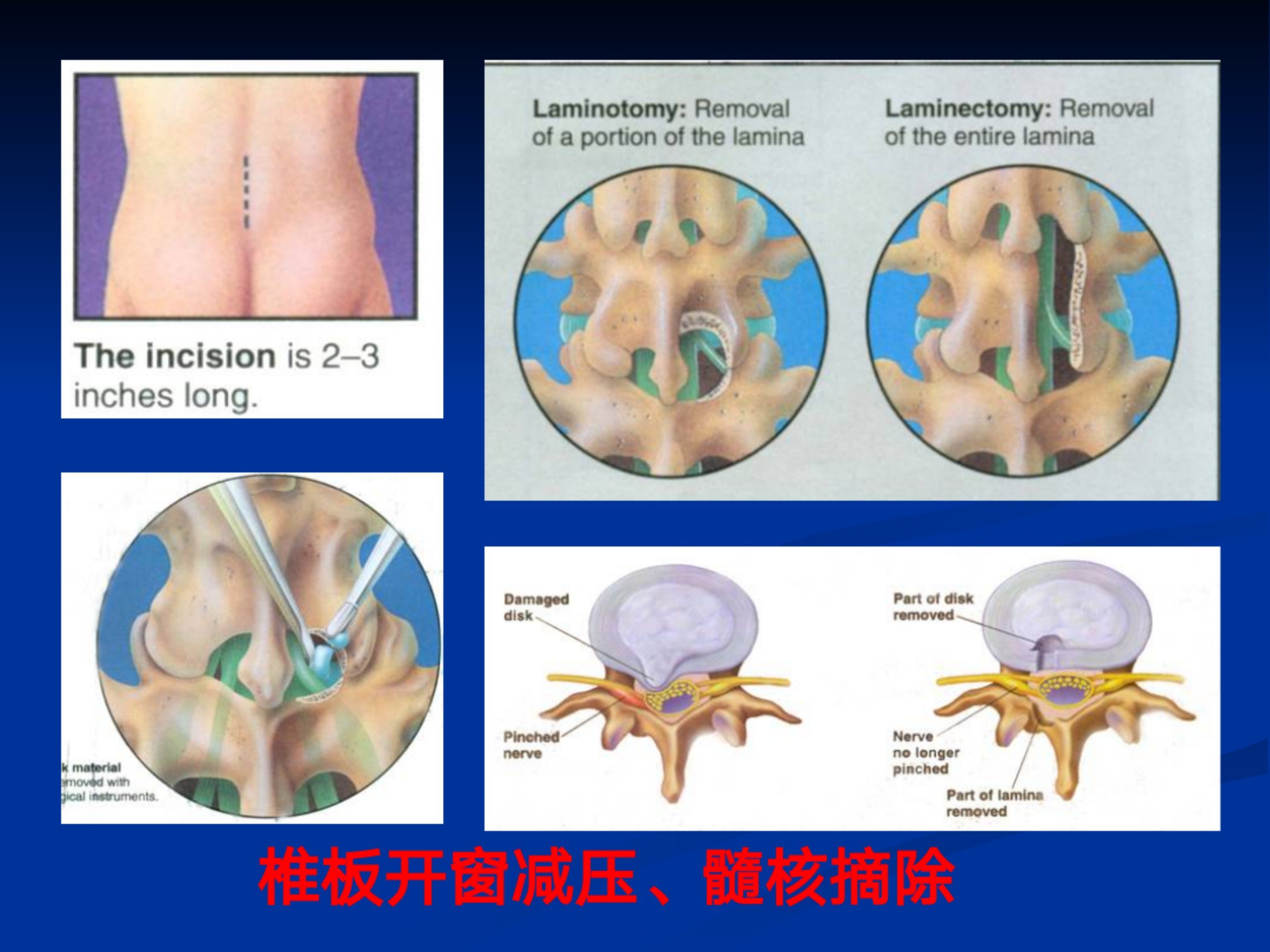 浅谈腰痛(1)_32.jpg