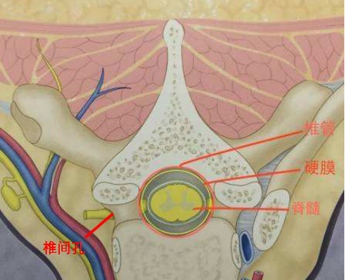椎管矢状径图片