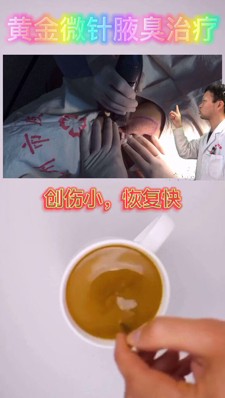 視頻封面