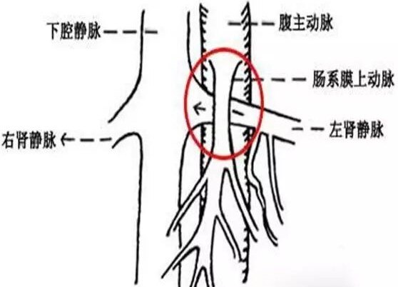 精索静脉走行图片