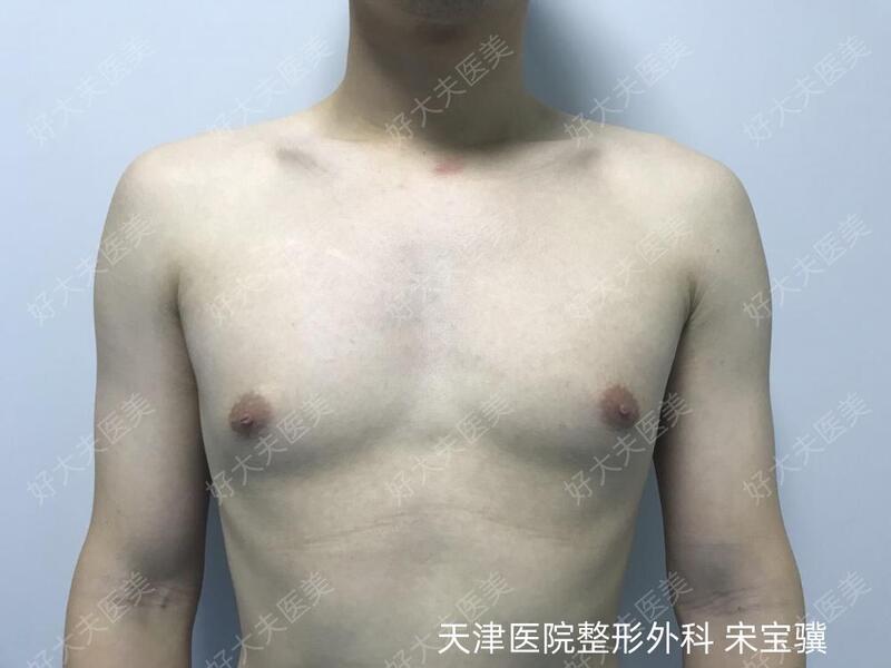 圖文圖片