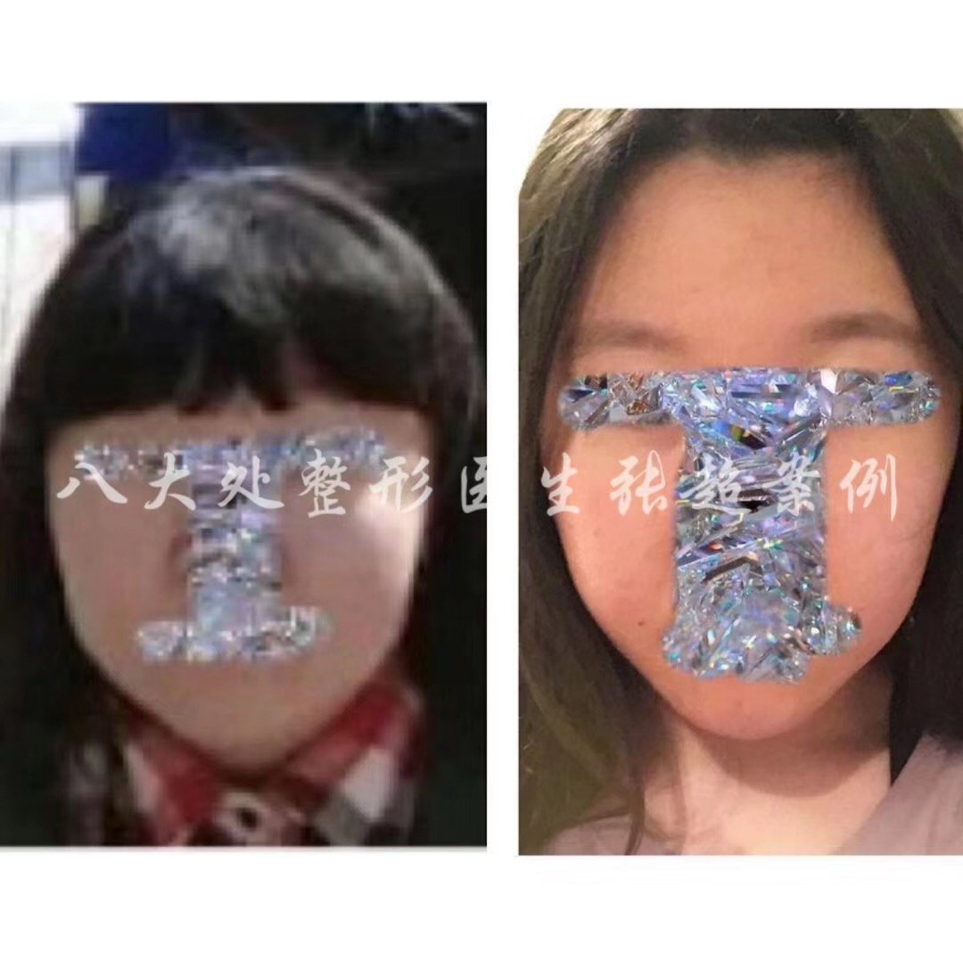 暂无