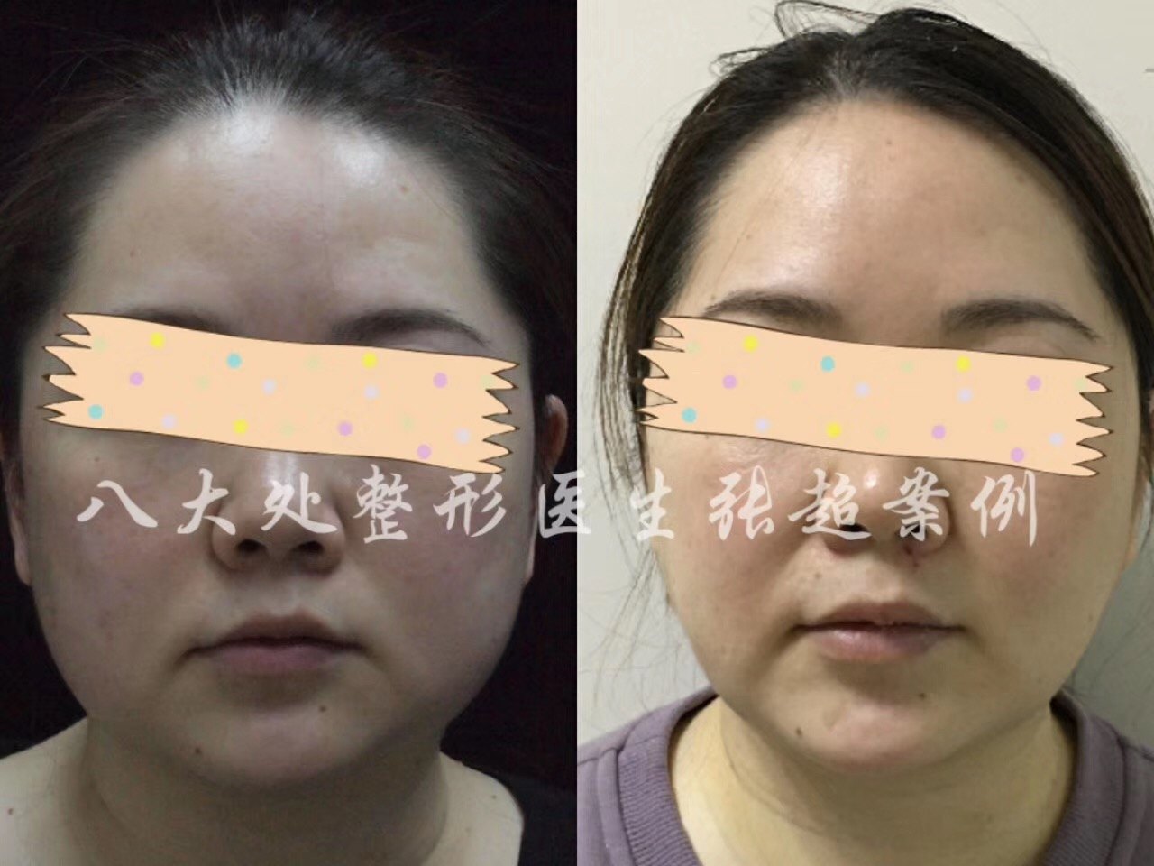 暂无