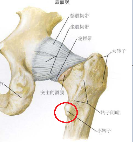股骨小转子位置图片