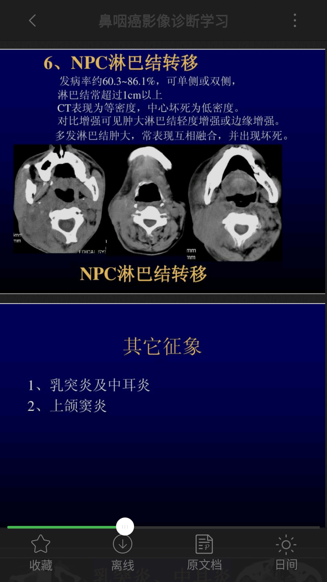 鼻咽ct.mri表現