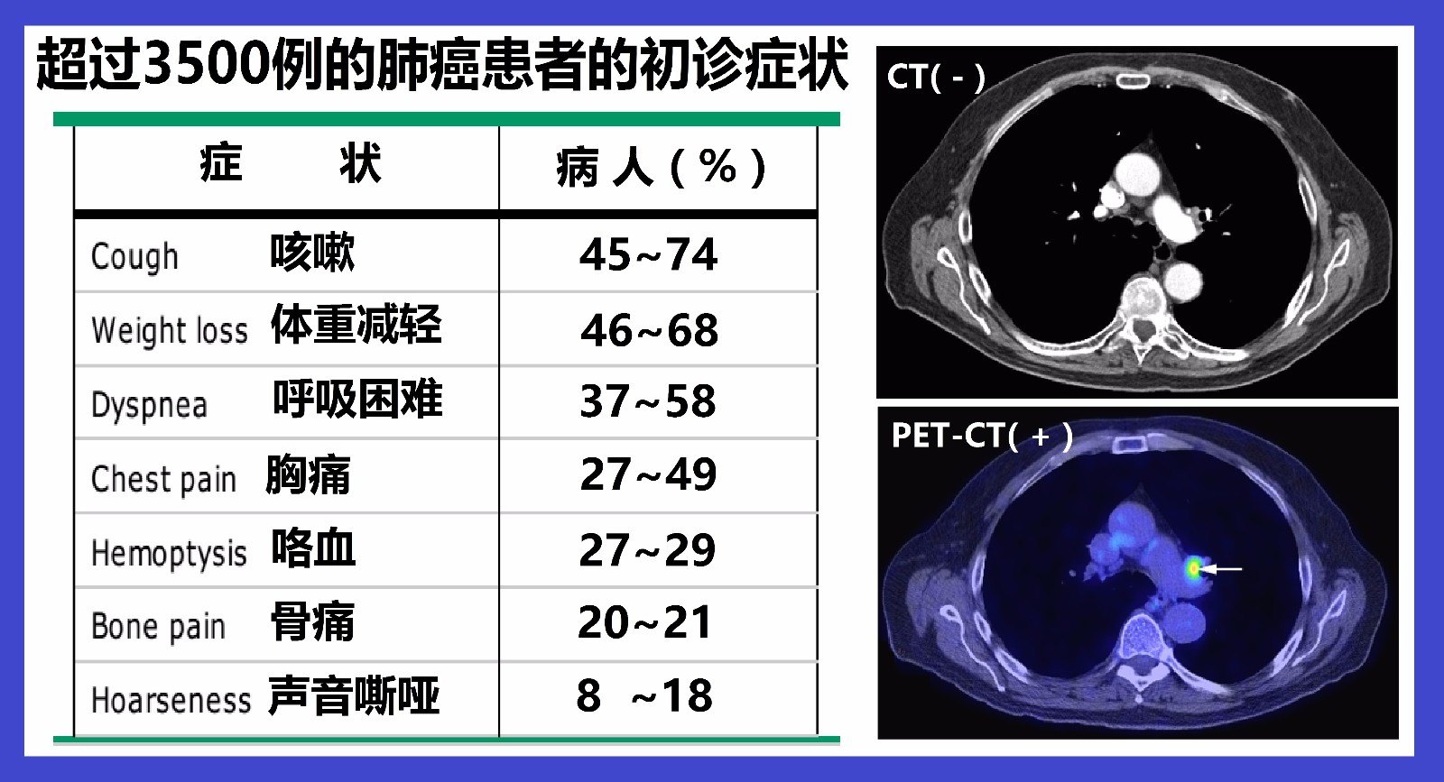 haodf:8:feiai-->肺癌 !--haodf:/8:feiai-->的临床表现.jpg