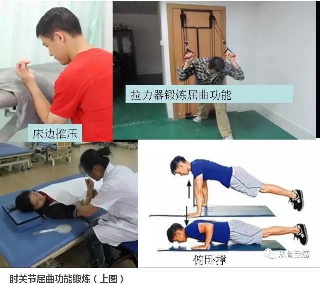 肘关节康复训练方法图图片