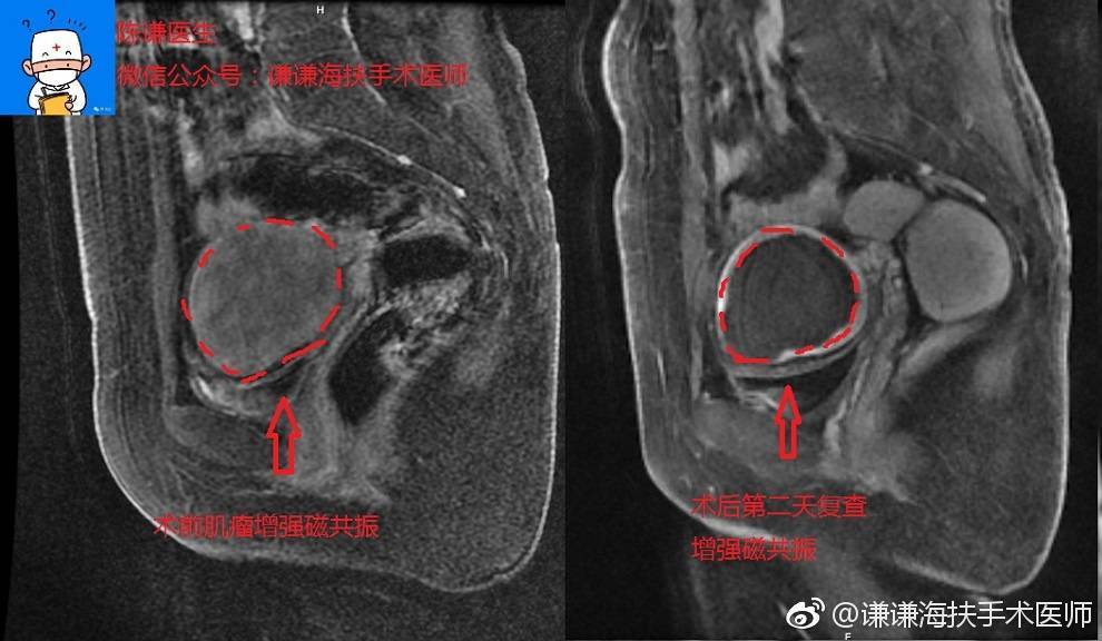 暂无