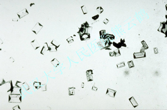 calcium_oxalate_dihydrate_crystals-109.jpg