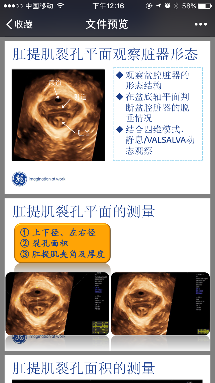 我院在温州地区率先开展盆底三维超声检查,无创检查,帮您评估盆底功能
