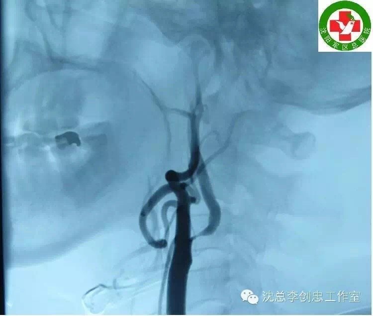 暂无