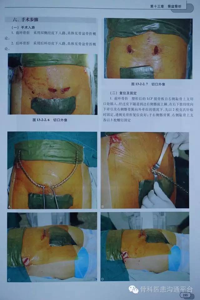 一本带你走进"mipo手术技术"真人秀的优秀作品 - 好大夫在线