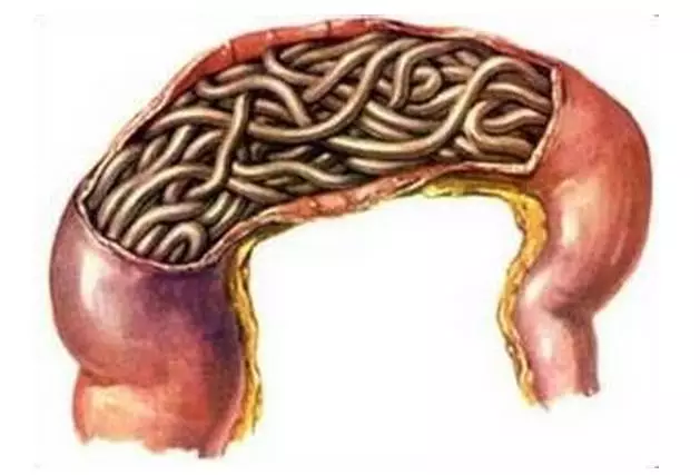 磨牙真的是肚子里有蛔虫? - 好大夫在线