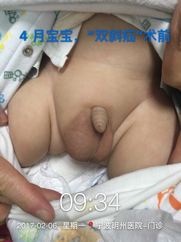 暂无