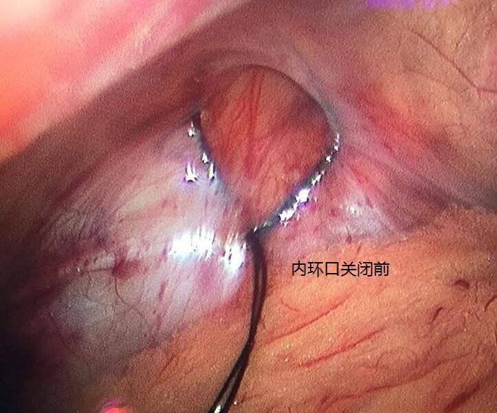 暂无