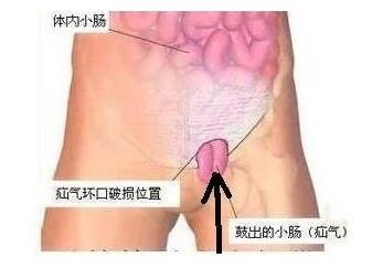 暂无