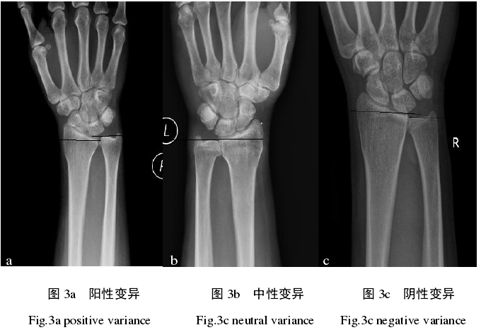 尺骨照片图片