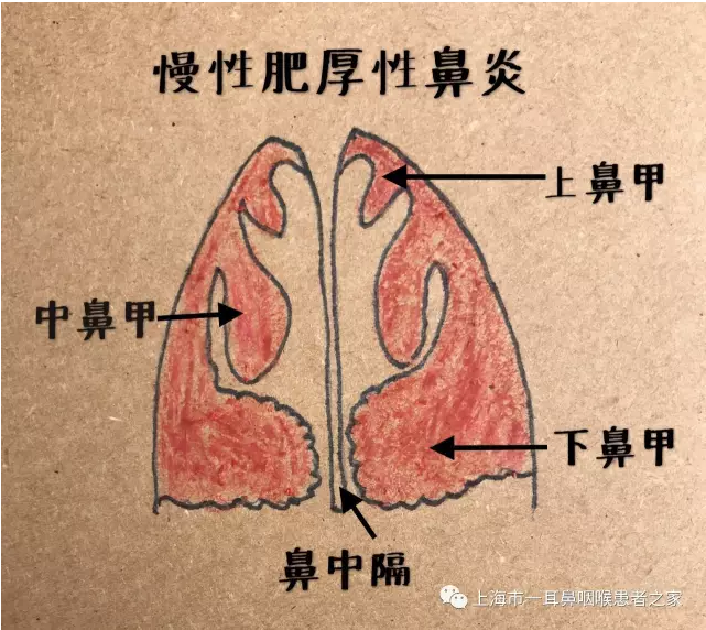 暂无