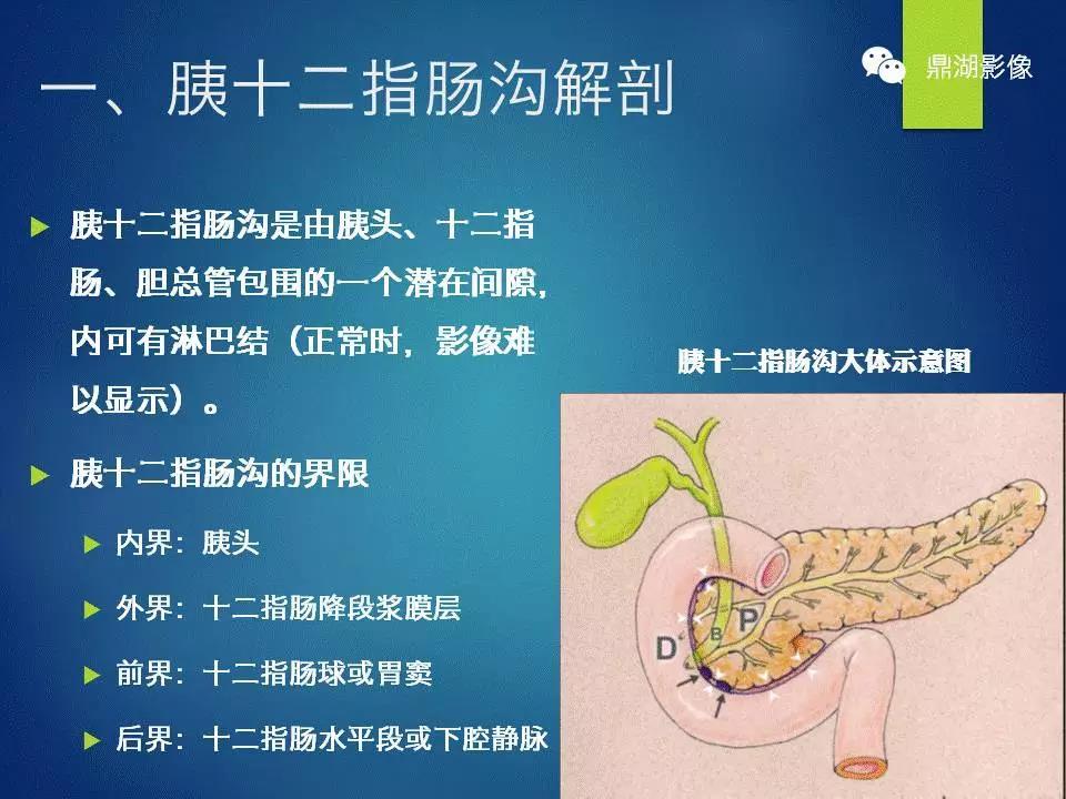 胰十二指腸溝部胰腺炎的影像學診斷與鑑別診斷