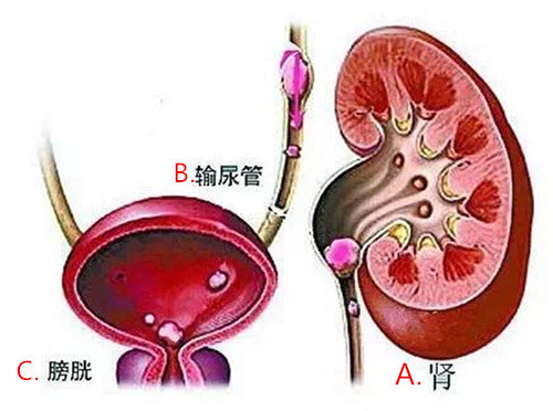 如果有以下