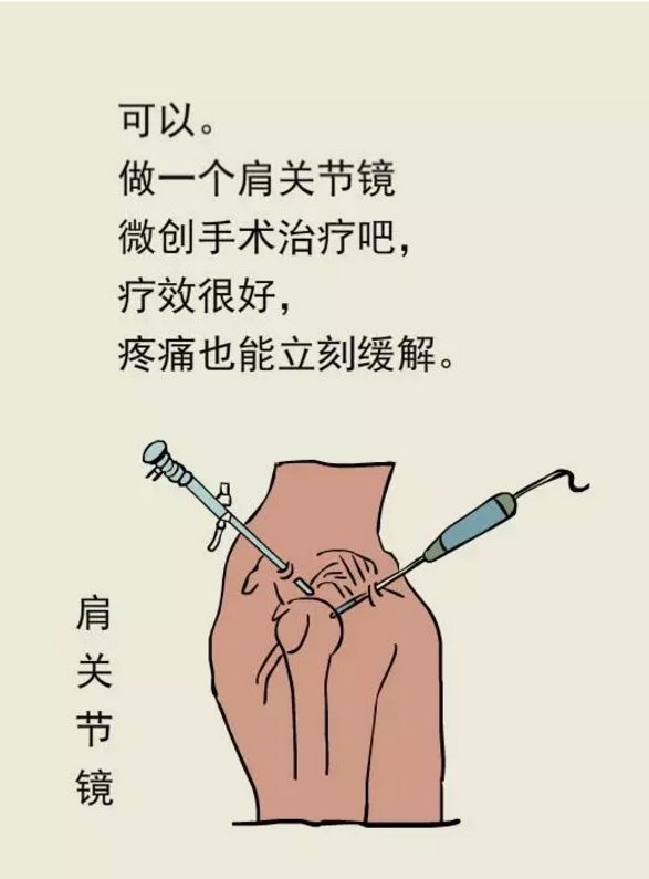 肌腱炎病肩周炎診斷誤區肩膀痛就是肩周炎