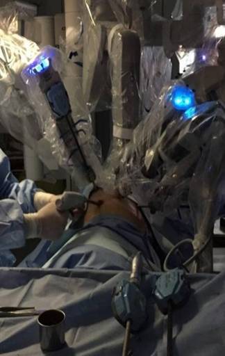 达芬奇手术机器人系统在肺癌微创外科治疗中的