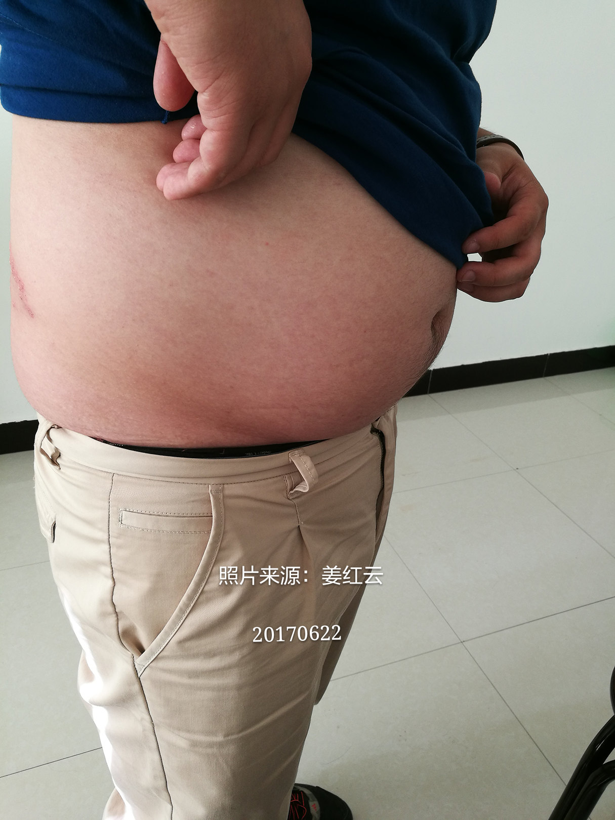 暂无
