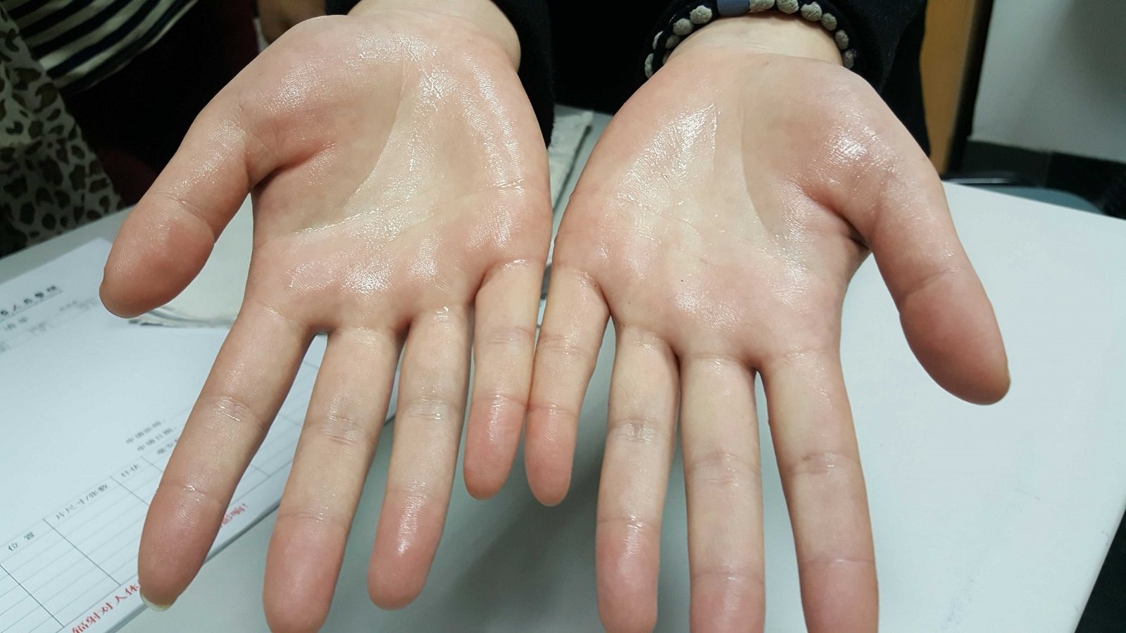 漏斗胸手汗症门诊368诊室或通过我的好大夫网站预约住院手术总费用(入