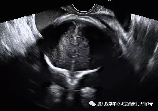 暂无