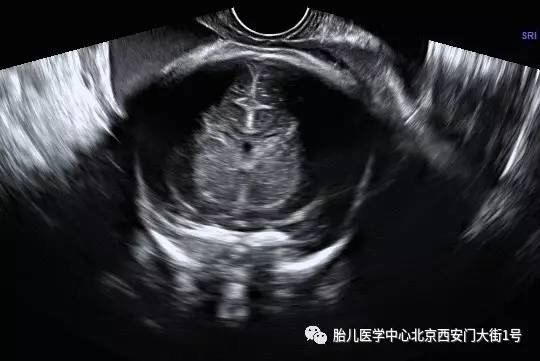 暂无