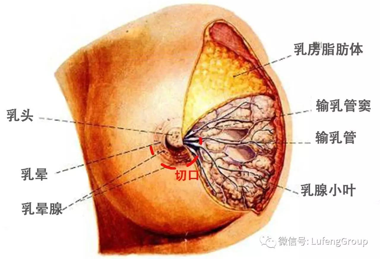 乳房下皱襞切口一年图片
