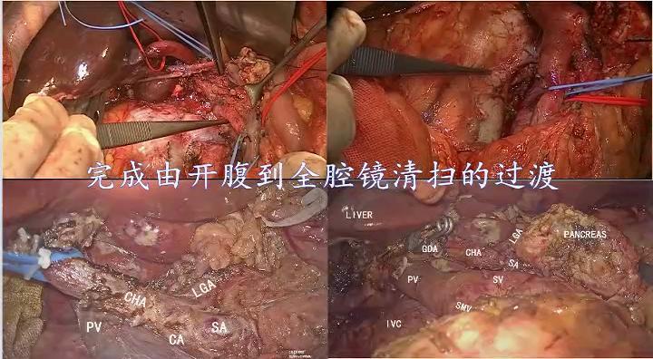 不忘初心繼續前進中山大學孫逸仙紀念醫院膽胰外科