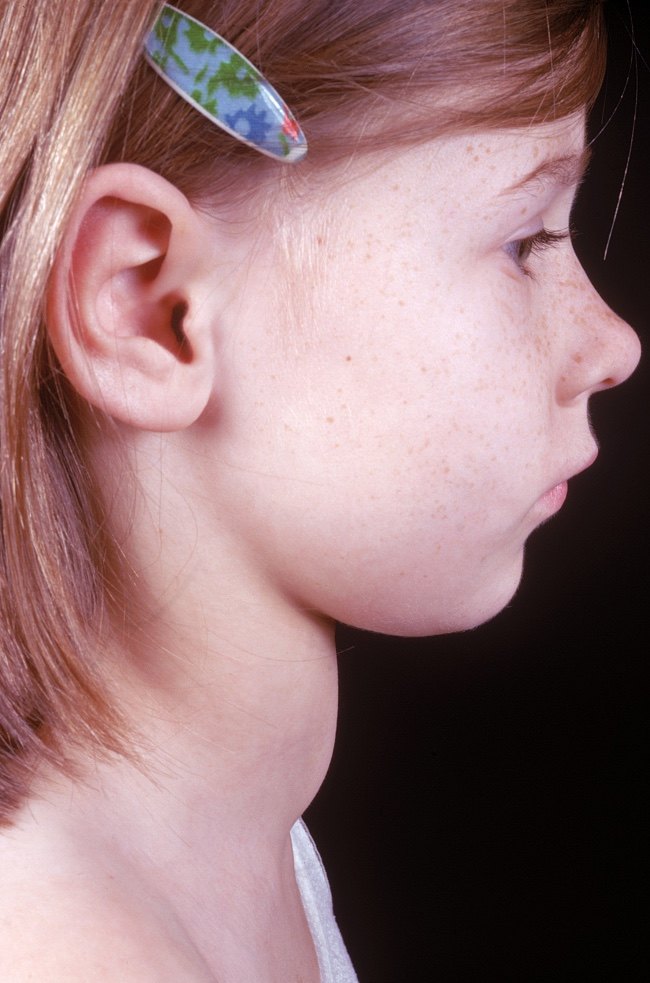 一点碘 不等闲_好大夫在线