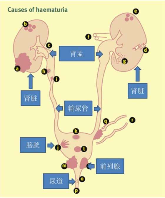 人的尿液在肾脏里产生,经过肾盂,输尿管,膀胱,尿道排出体外, 凡是