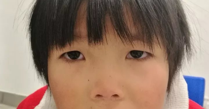 摘了眼镜,可以看出她的眼球并不小