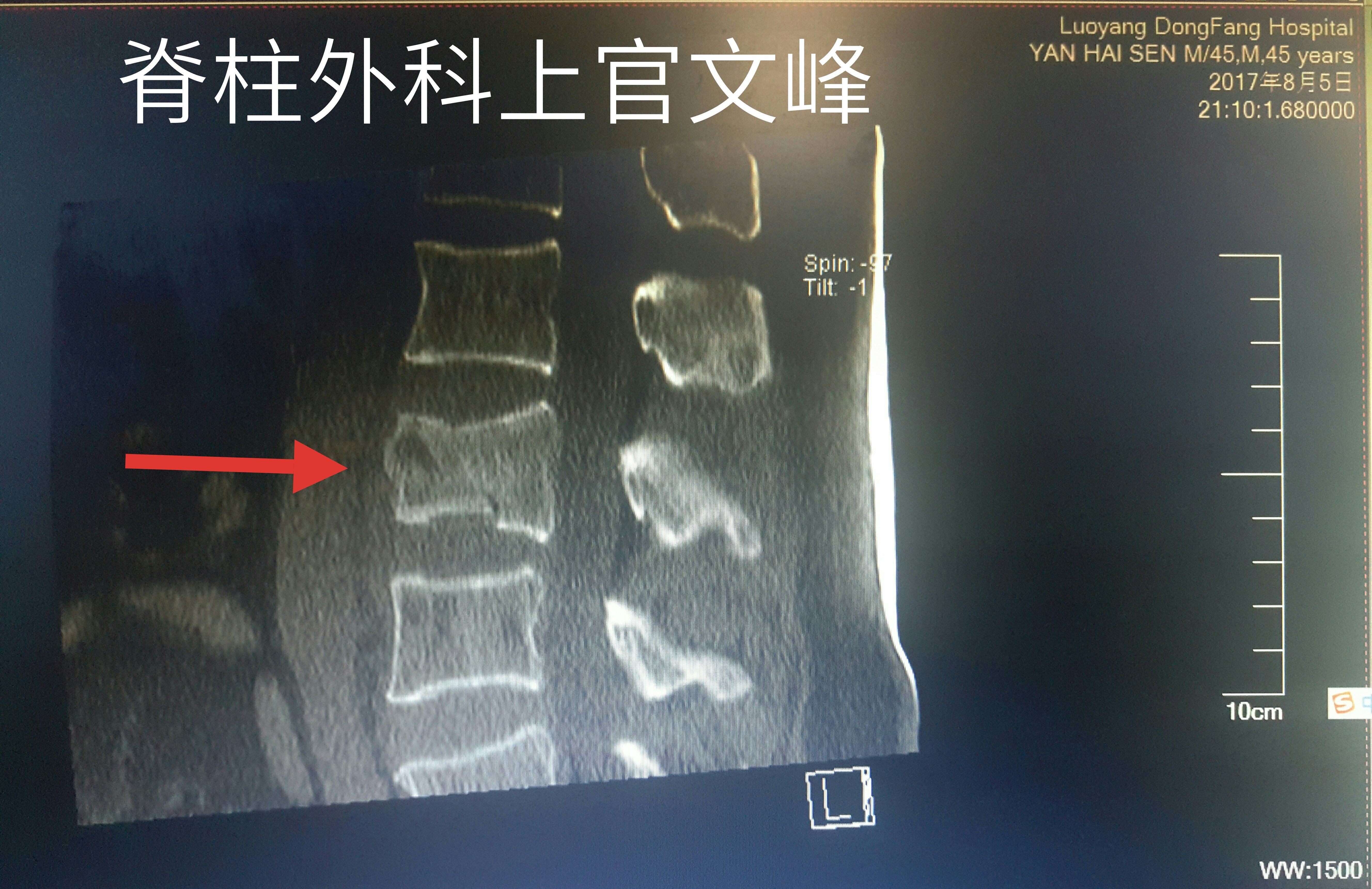 暂无