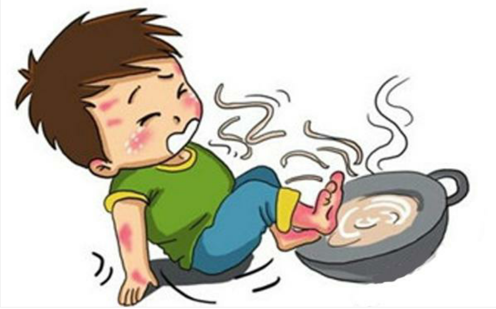 被开水烫伤怎么办?快速急救方法,一分钟就解决