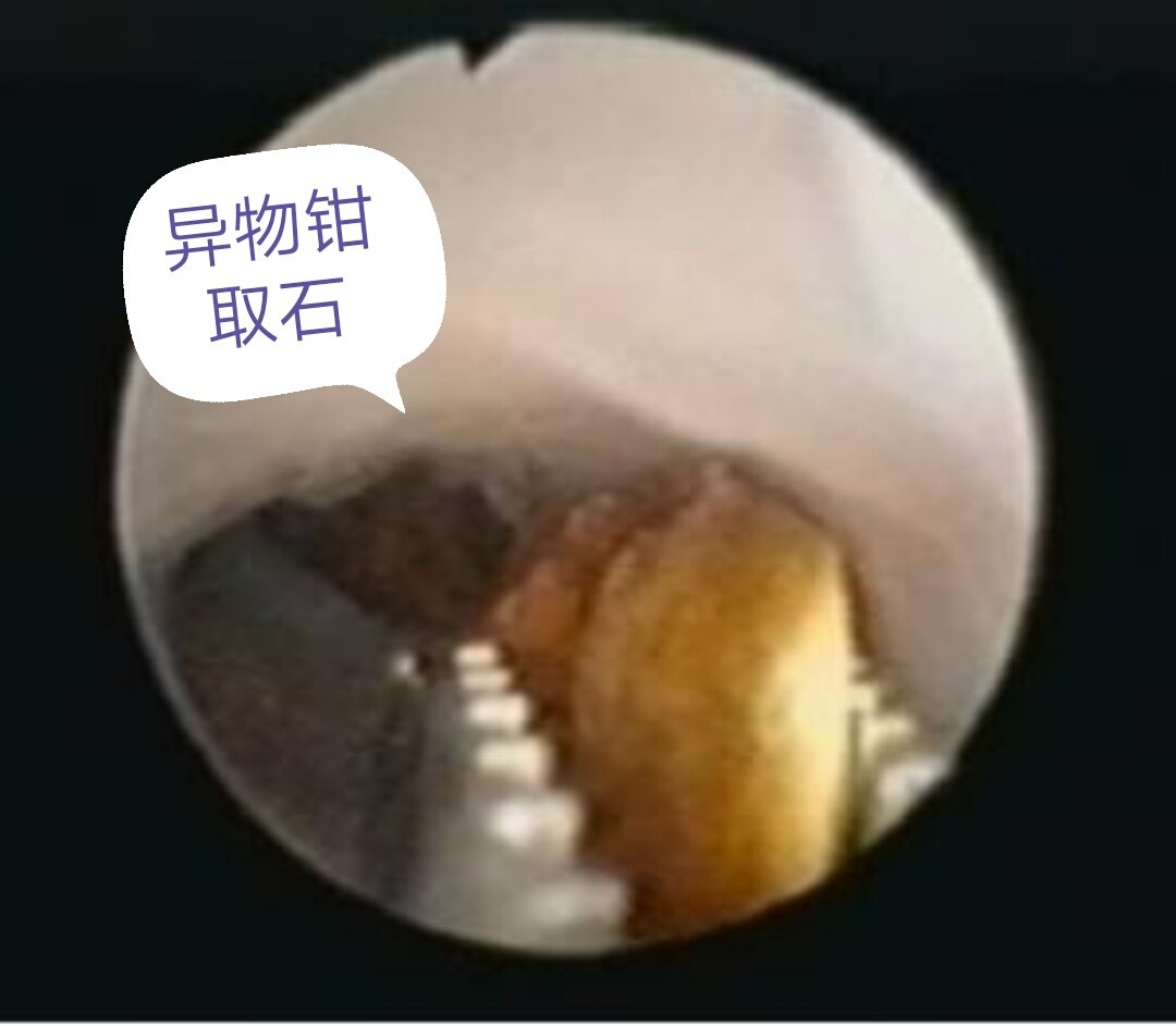 暂无