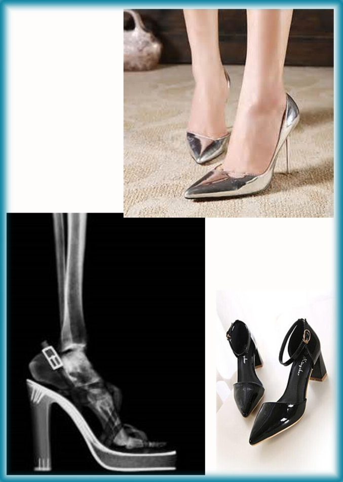 拇外翻_疾病介绍_治疗方法_介绍_治疗方式 - 好大夫在线