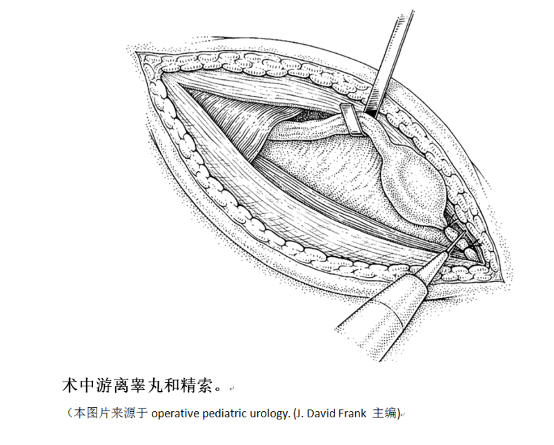 杨志林 文章列表 建议:家长要重视孩子的睾丸情况,给孩子洗澡的时候摸