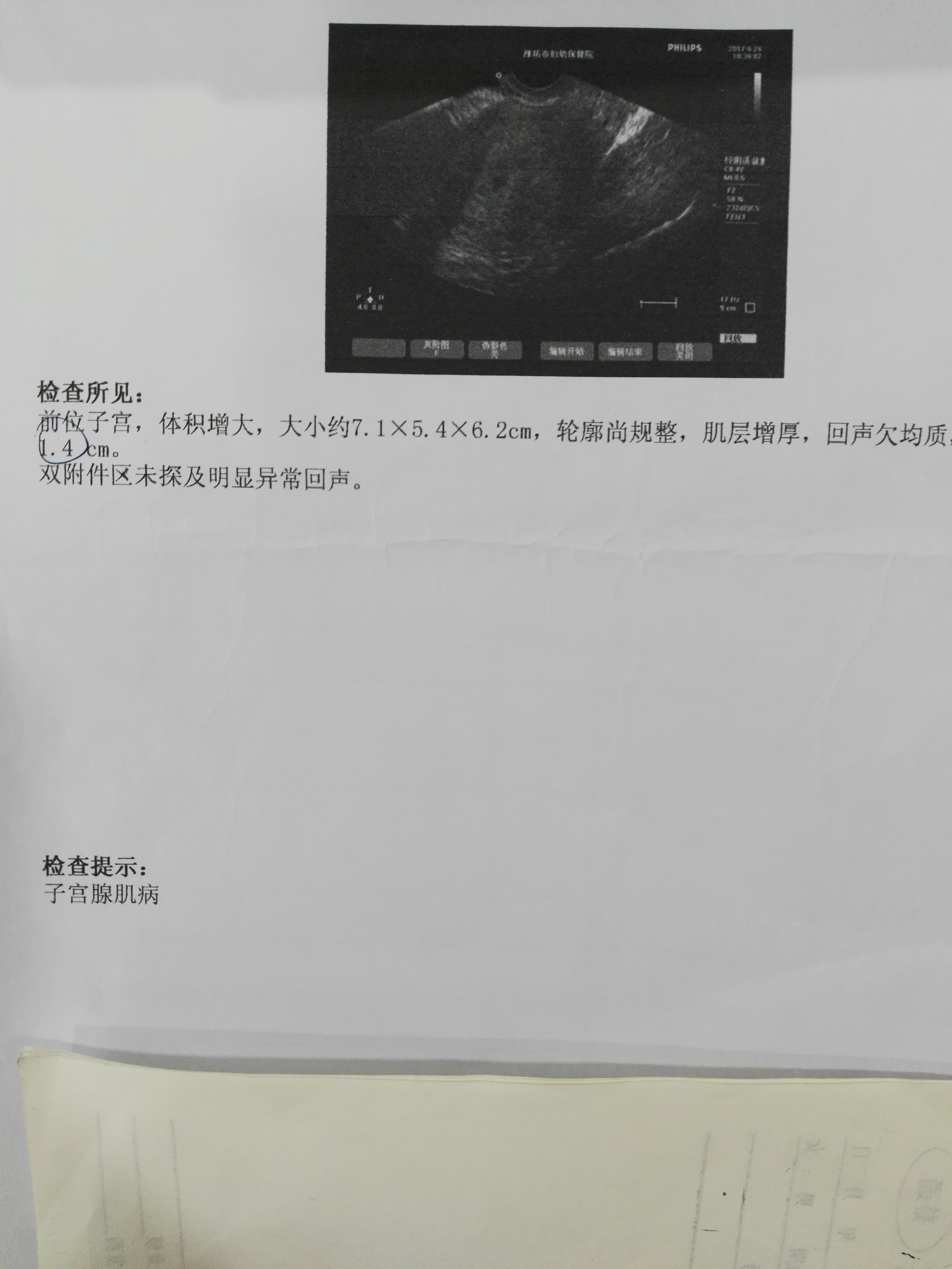 教你学会自己看妇科彩超报告单