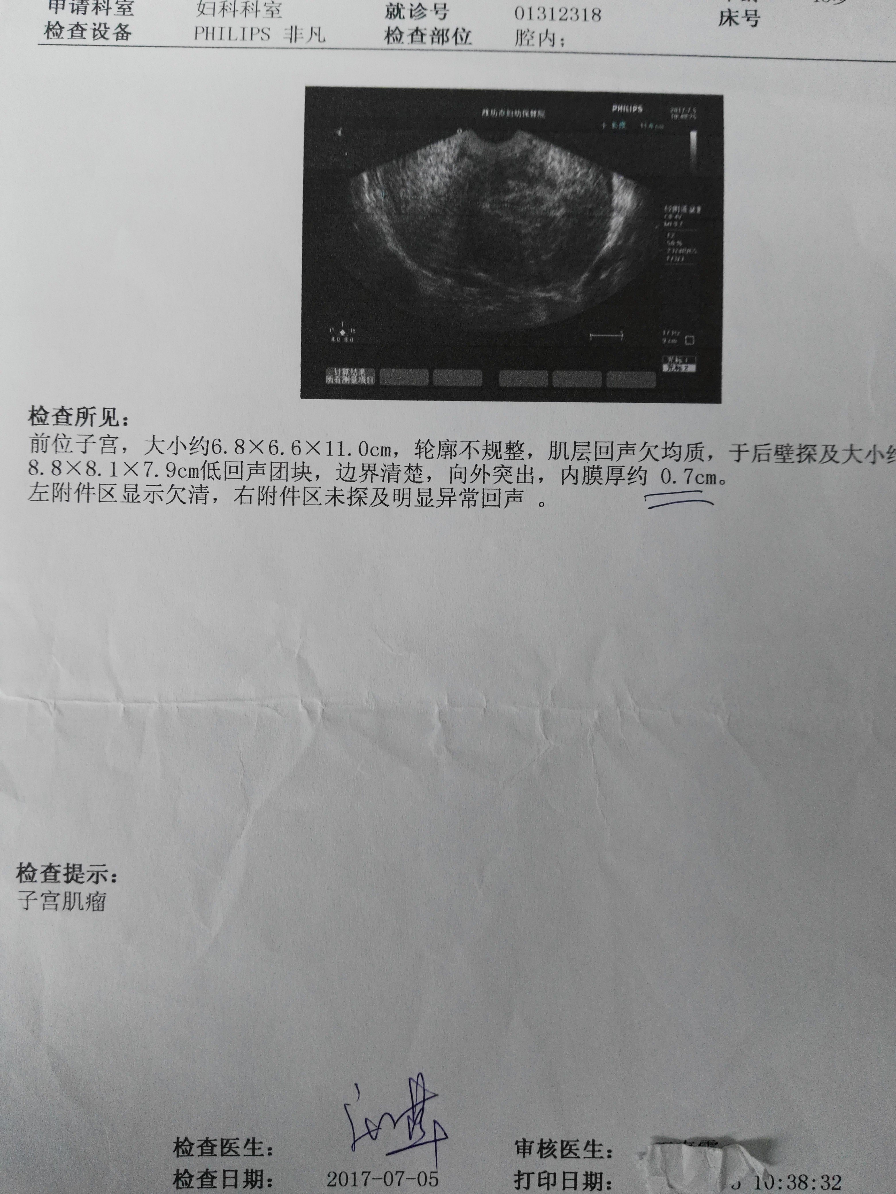 教你学会自己看妇科彩超报告单