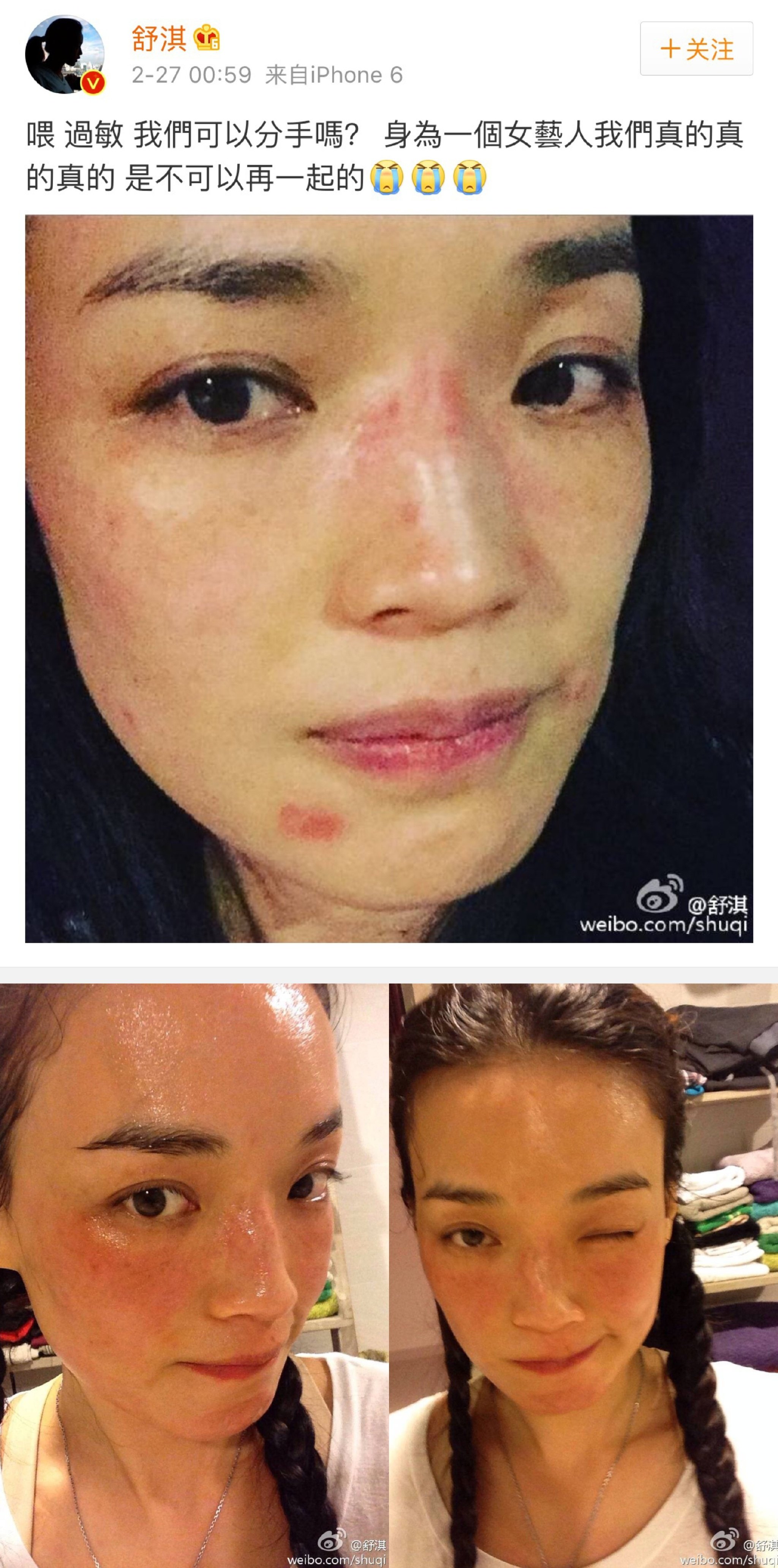 皮肤红 痒 肿起风团 怎么回事 你是过敏啦 好大夫在线 皮肤红 痒 肿起风团 怎么回事 你是过敏啦 好大夫在线