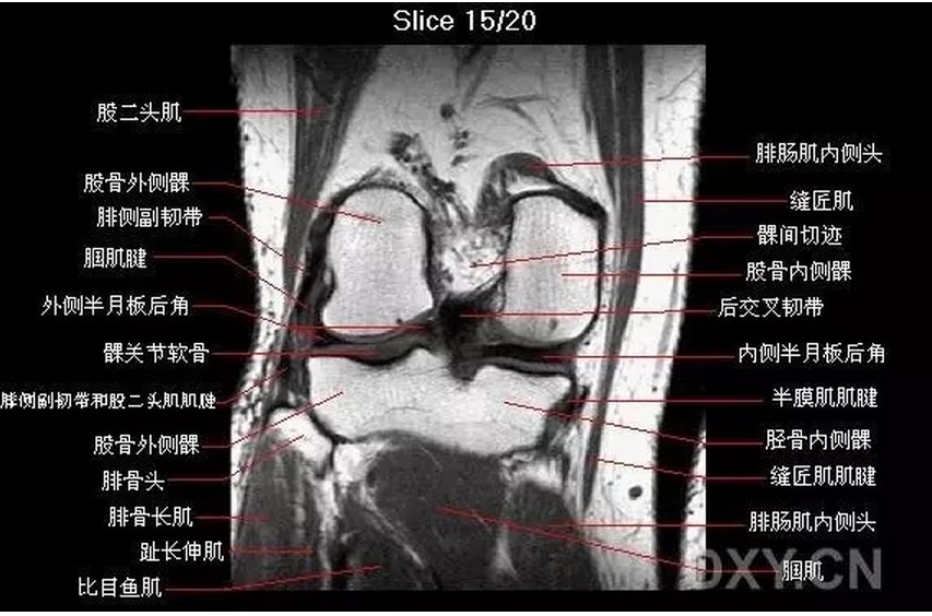 膝关节CT解剖图图片